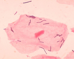 Lactobacillus tejsavbaktérium Füvészblog